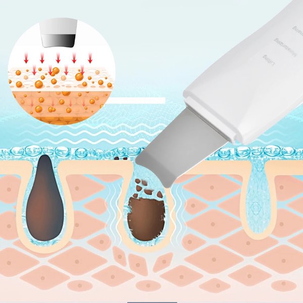 Limpiador Facial Ultrasónico 3 En 1